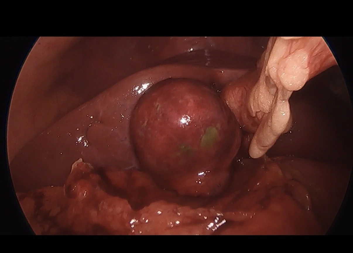 Cirugía de emergencia