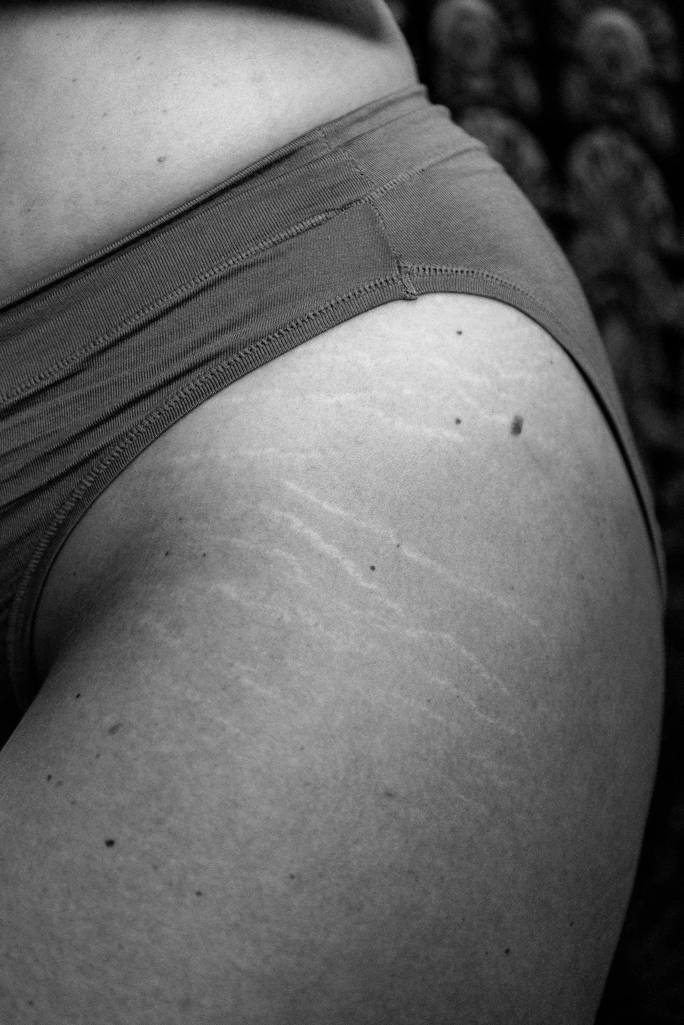 Close-up black-and-white photo of a person's waist wearing underwear, stretch marks on skin