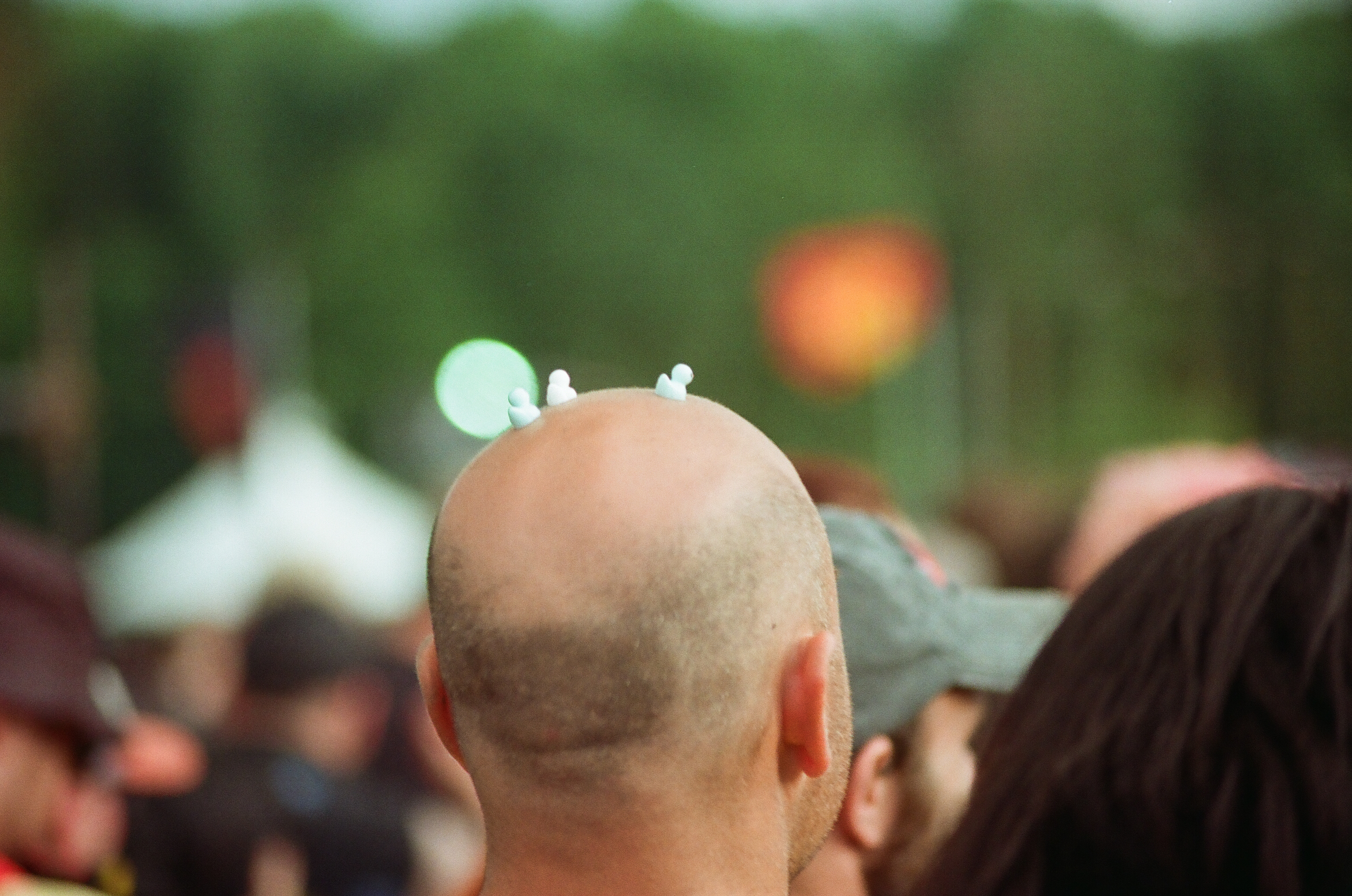 A bald man with a few small white foam balls balanced on his head, seen from behind, at an outdoor event with many people and green trees in the background.