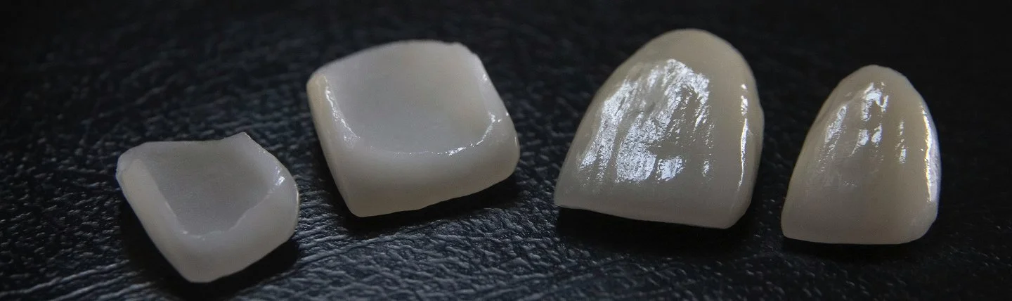 Präzisionsgefertigter, metallfreier Zahnersatz aus Vollkeramik