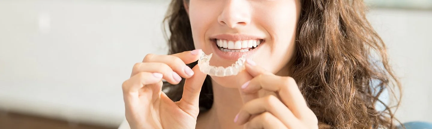 Frau setzt transparente Invisalign-Schiene zur Zahnkorrektur ein