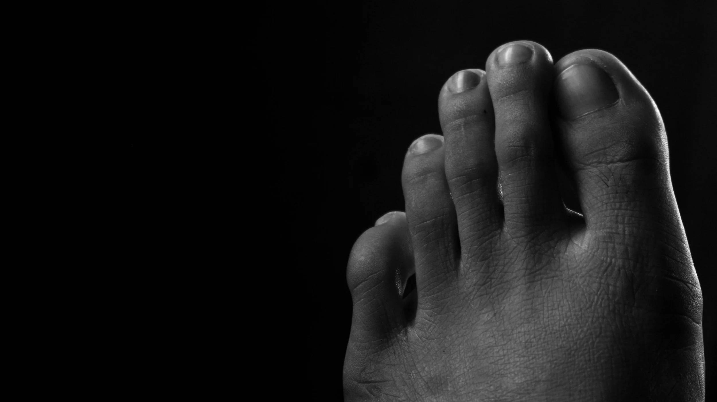 image of a foot for an article about limb ischemia