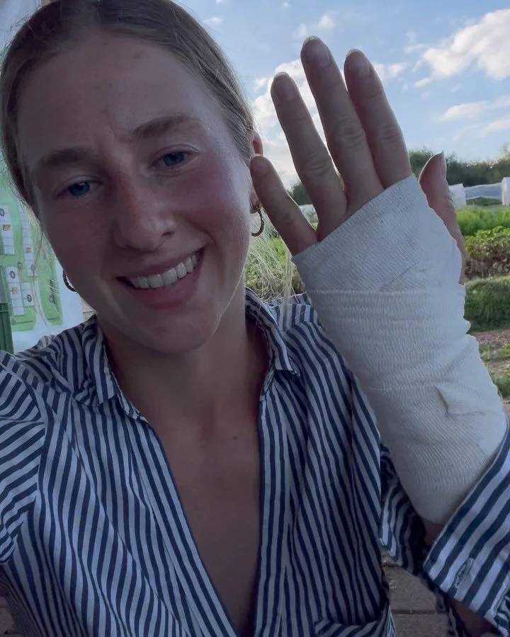 Letzte Woche bin ich mit dem Riesenbarenklau in Kontakt gekommen &ndash; und das war alles andere als harmlos. 🌿
Der Pflanzensaft reagiert in Kombination mit Sonnenlicht und f&uuml;hrt dazu, dass die Haut keinen nat&uuml;rlichen Schutz mehr hat. Das