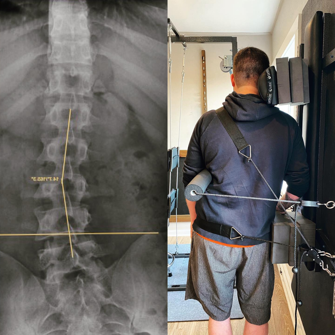 Chiropractor Spine Traction