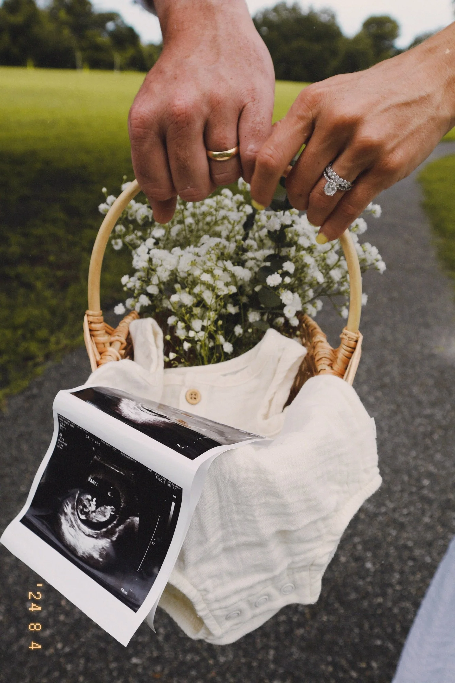 Hands holding a basket with baby items, flowers, and an ultrasound photo