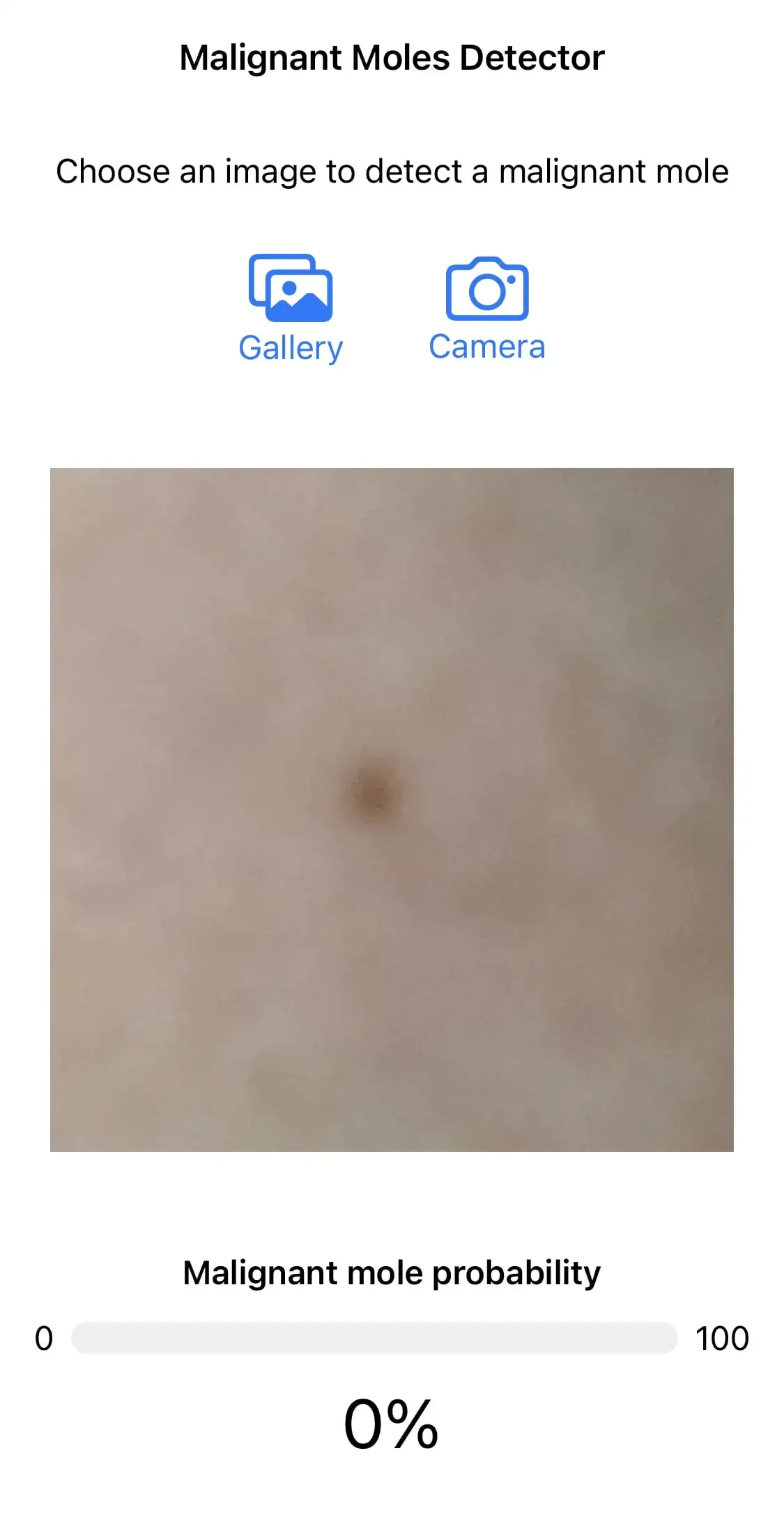 📱 Malignant moles detector