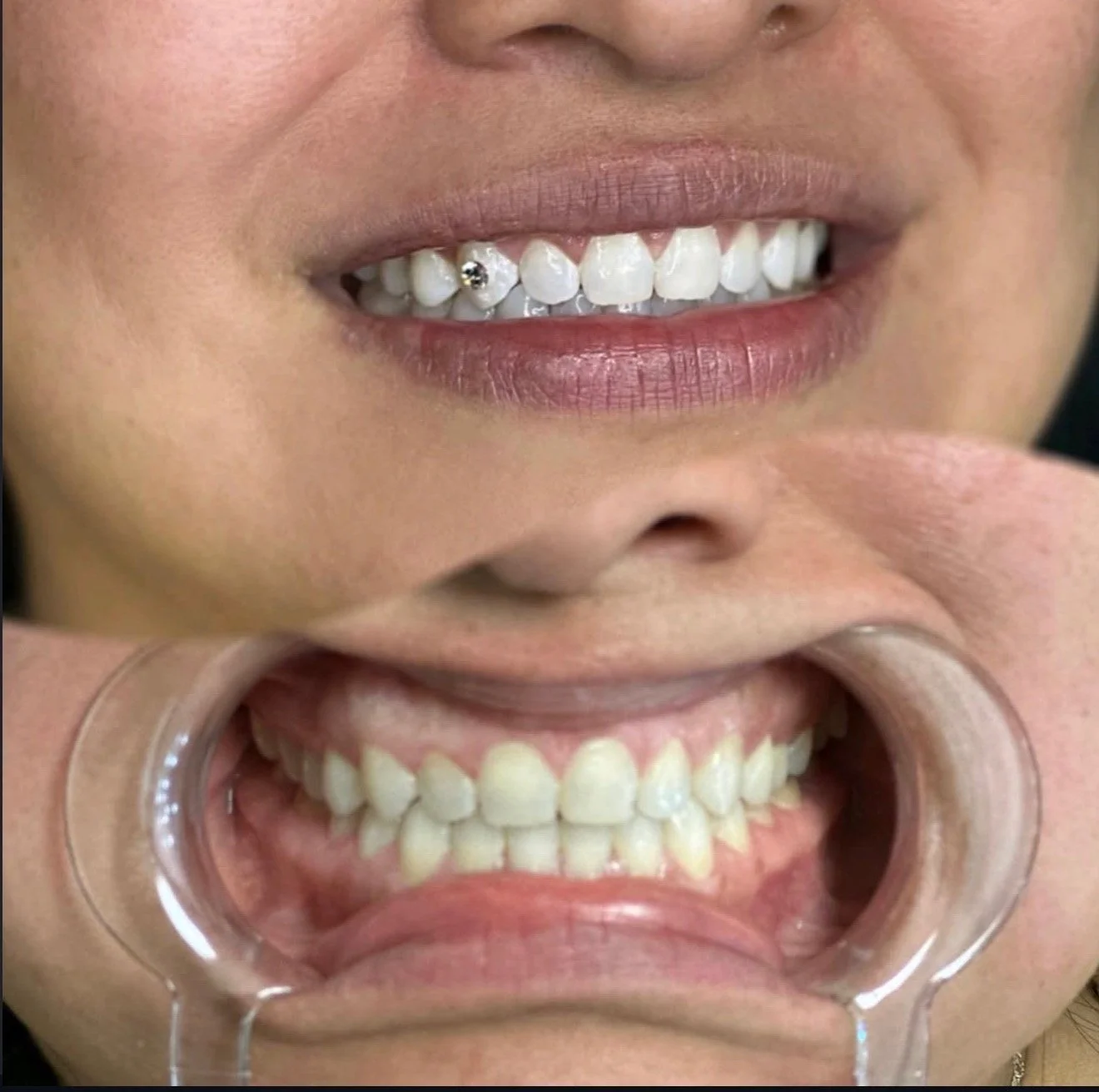 Close-up of a person's face smiling, showing teeth with a small decorative gem, 
Castrian Makeup Studio; Emily Gonzalez; Atlanta, Georgia; Bridal Make-Up; Norcross, Spanish Make-Up Artist; Tooth Gems
