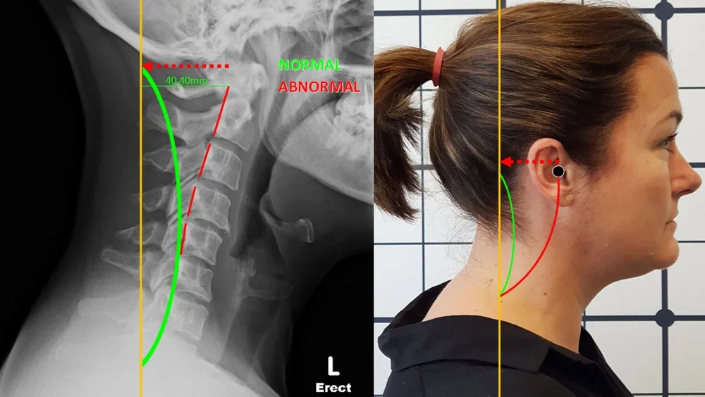 Our new patient consultation includes X-rays for your condition