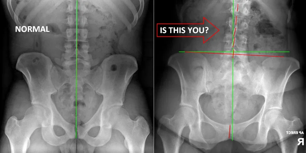 Your $49 New Patient Visit at Innate Ward Chiro includes Digital X-ray Analysis