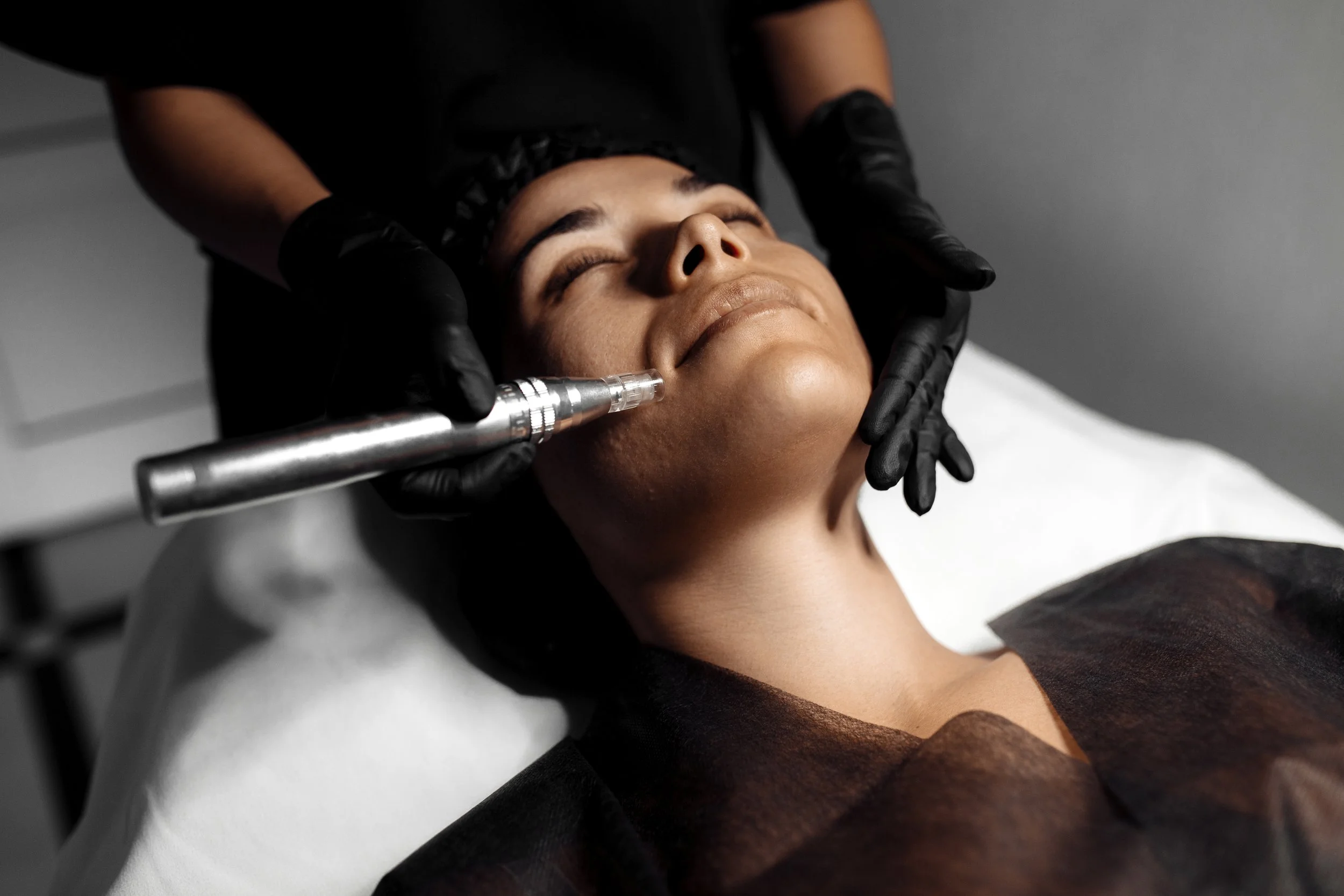 Microneedling Facial