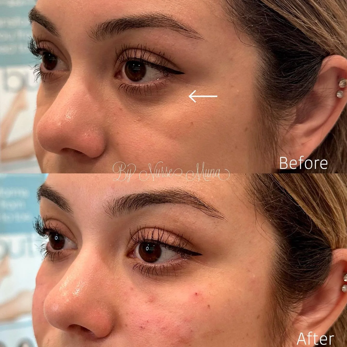 Medspa Services in Huntington Beach, CA, 92649