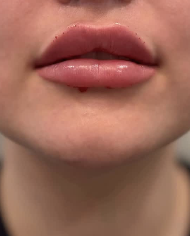 Best Medspa in Huntington Beach, CA, 92649