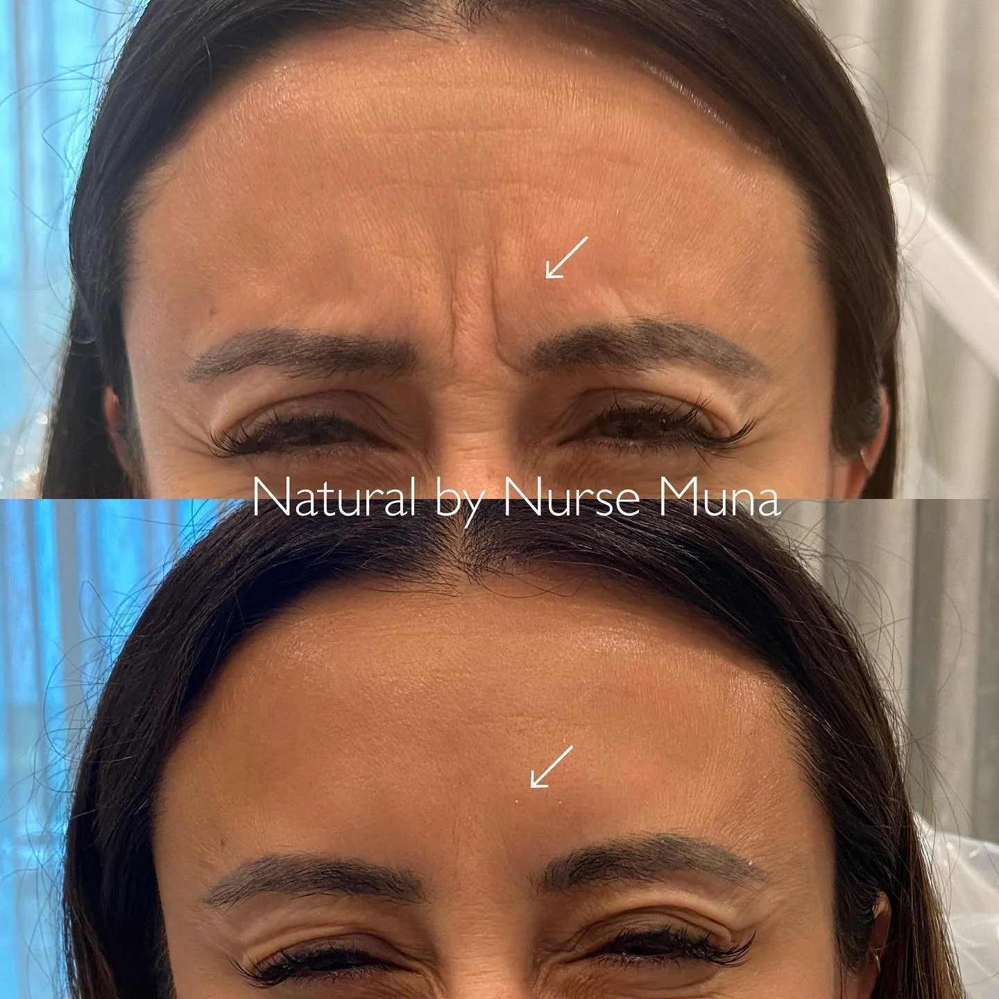 Medspa Services in Huntington Beach, CA, 92649