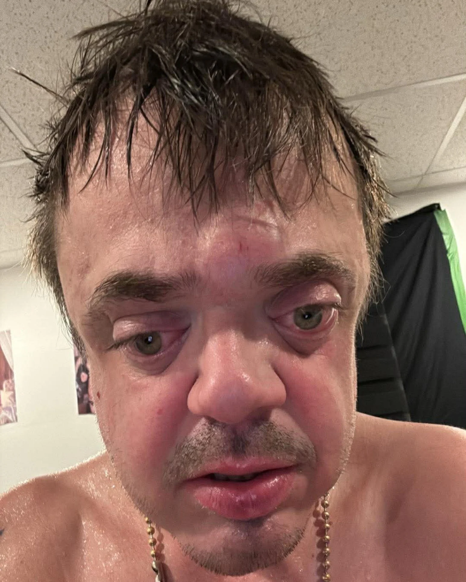 Je suis fort&hellip; mais oui, j&rsquo;ai aussi des &eacute;preuves et des limitations dont je parle peu. 

Je me suis adapt&eacute; toute ma vie, mais certains mouvements restent impossibles. 

Hier, il m&rsquo;est arriv&eacute; quelque chose...

Je