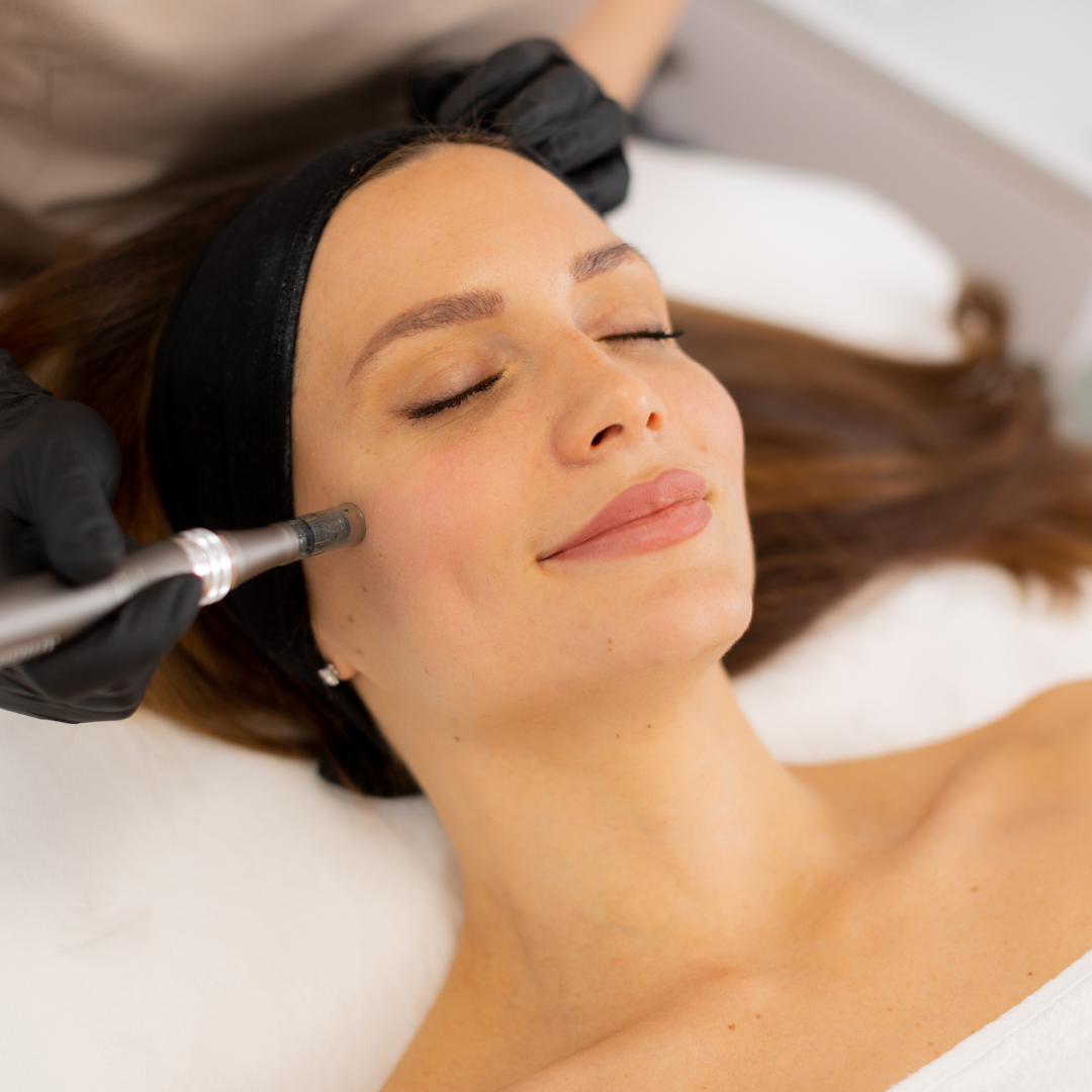 Medspa in Brea, CA 92821 l Microneedling Near Me
