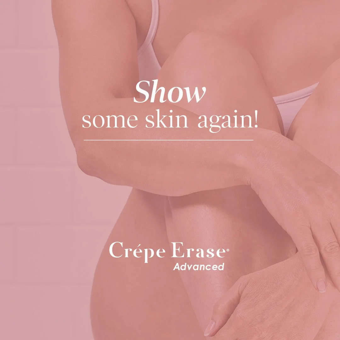 A female model with smooth skin and arms crossed, promoting Crêpe Erase Advanced skincare product with the text 'Show some skin again!'