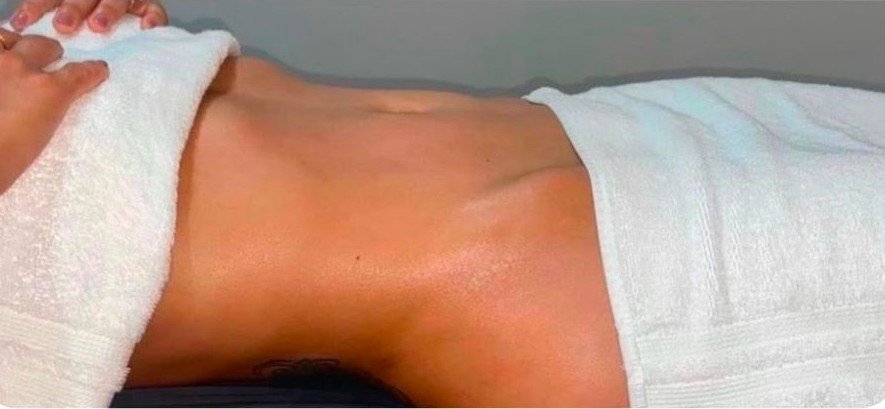Close-up of a person's lower back with the skin appearing red and irritated, partially covered by a towel.