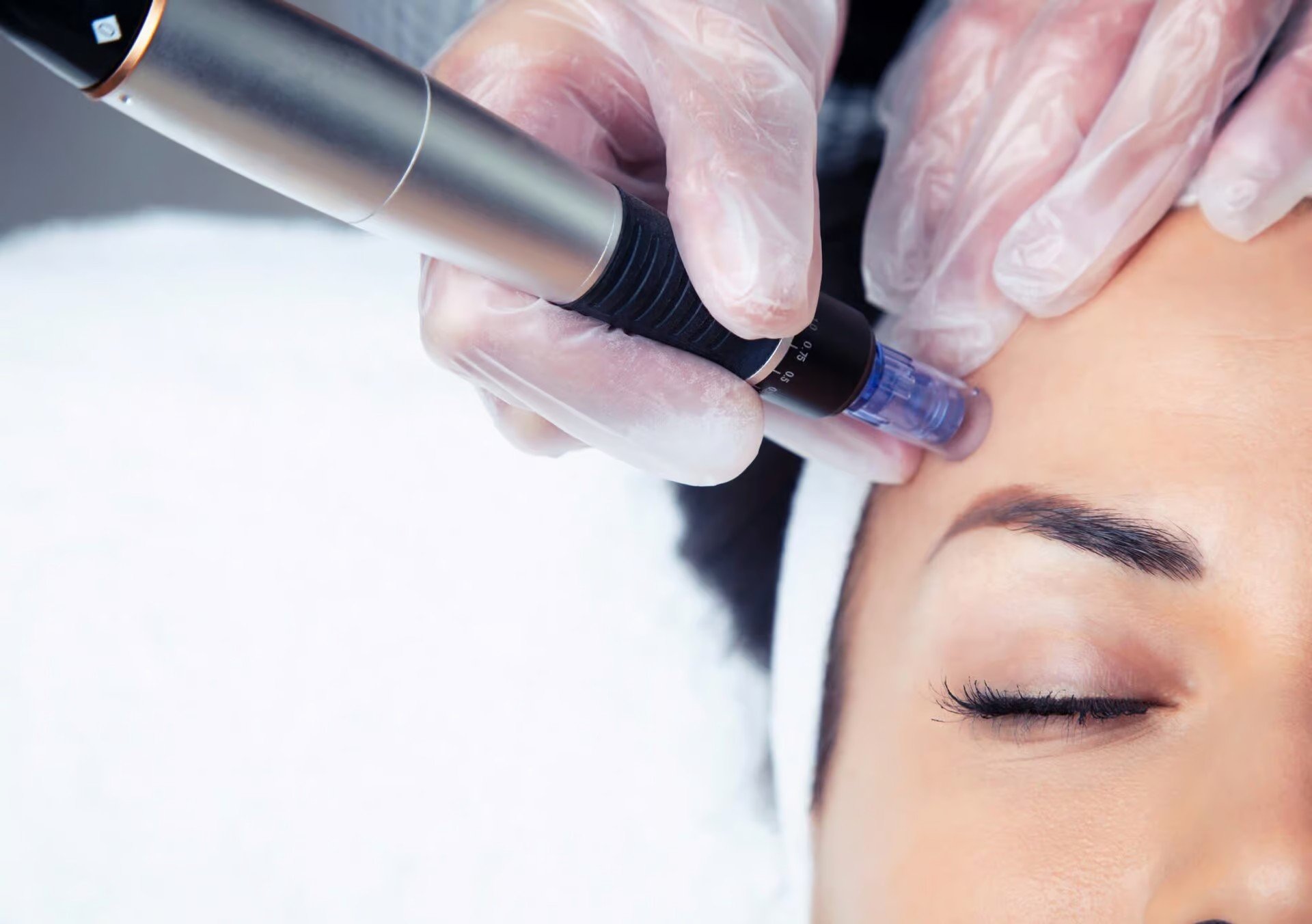 A person receives a micro needling/skin pen treatment, with a technician using a device near their eyebrow while wearing gloves.