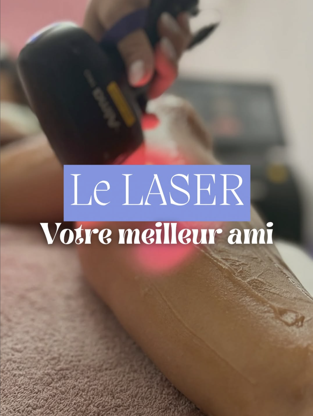 Épilation Laser Définitive : une peau lisse durablement