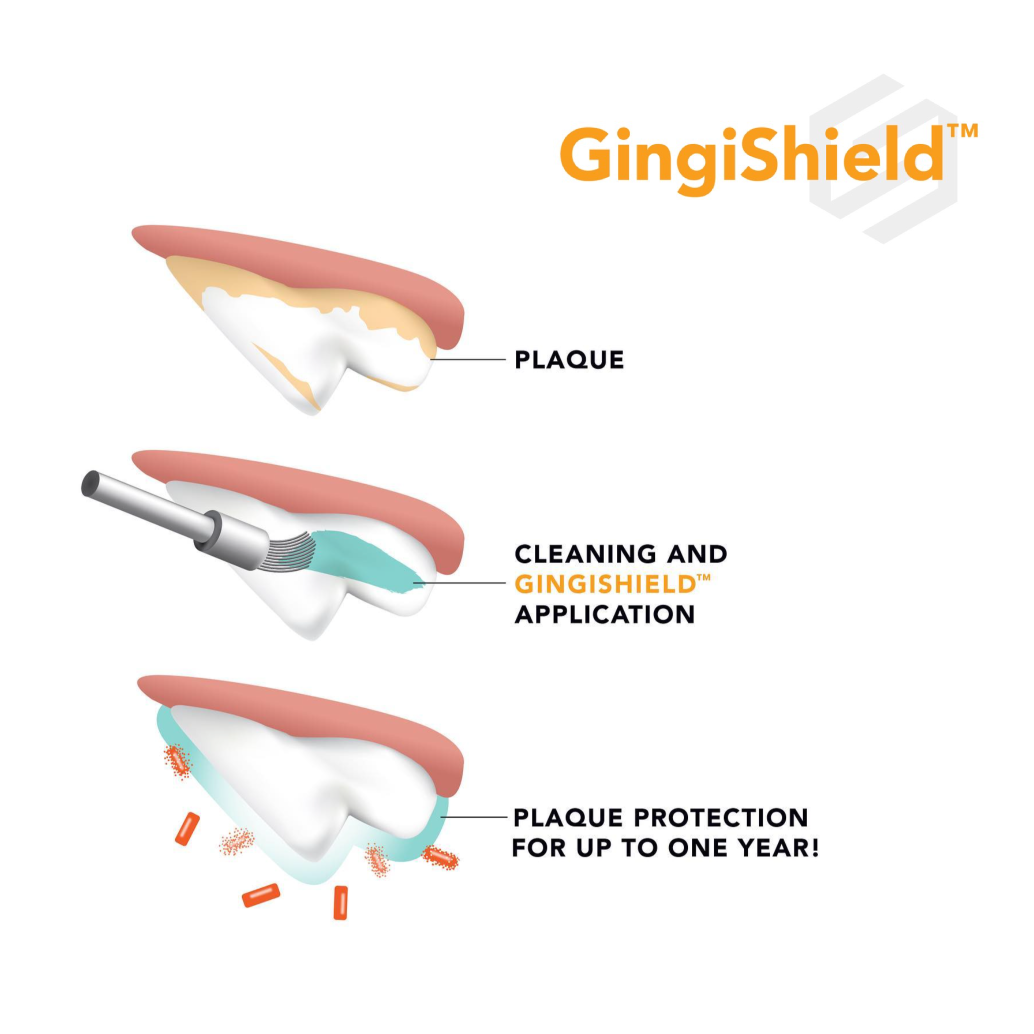 tooth-demonstration-gingishield.png