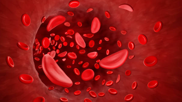 An image showing the difference between flexible, round red blood cells and rigid, crescent-shaped sickled cells.
