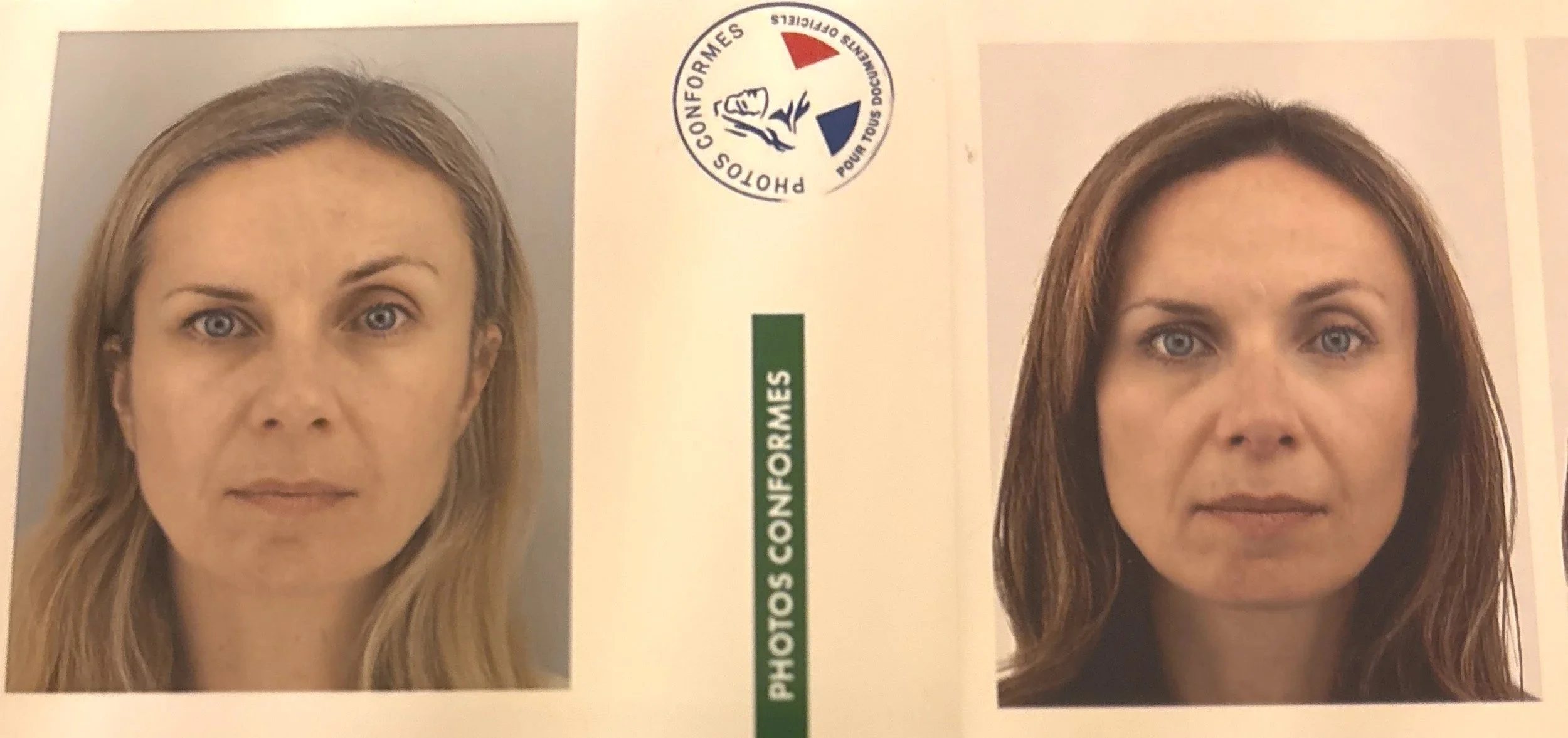 Mieux vieillir naturellement avant après naturopathie Biarritz Anne-Sophie Mathieu