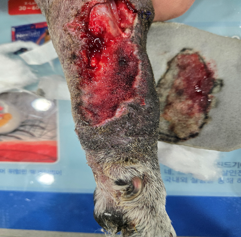 Surgical Wound Management