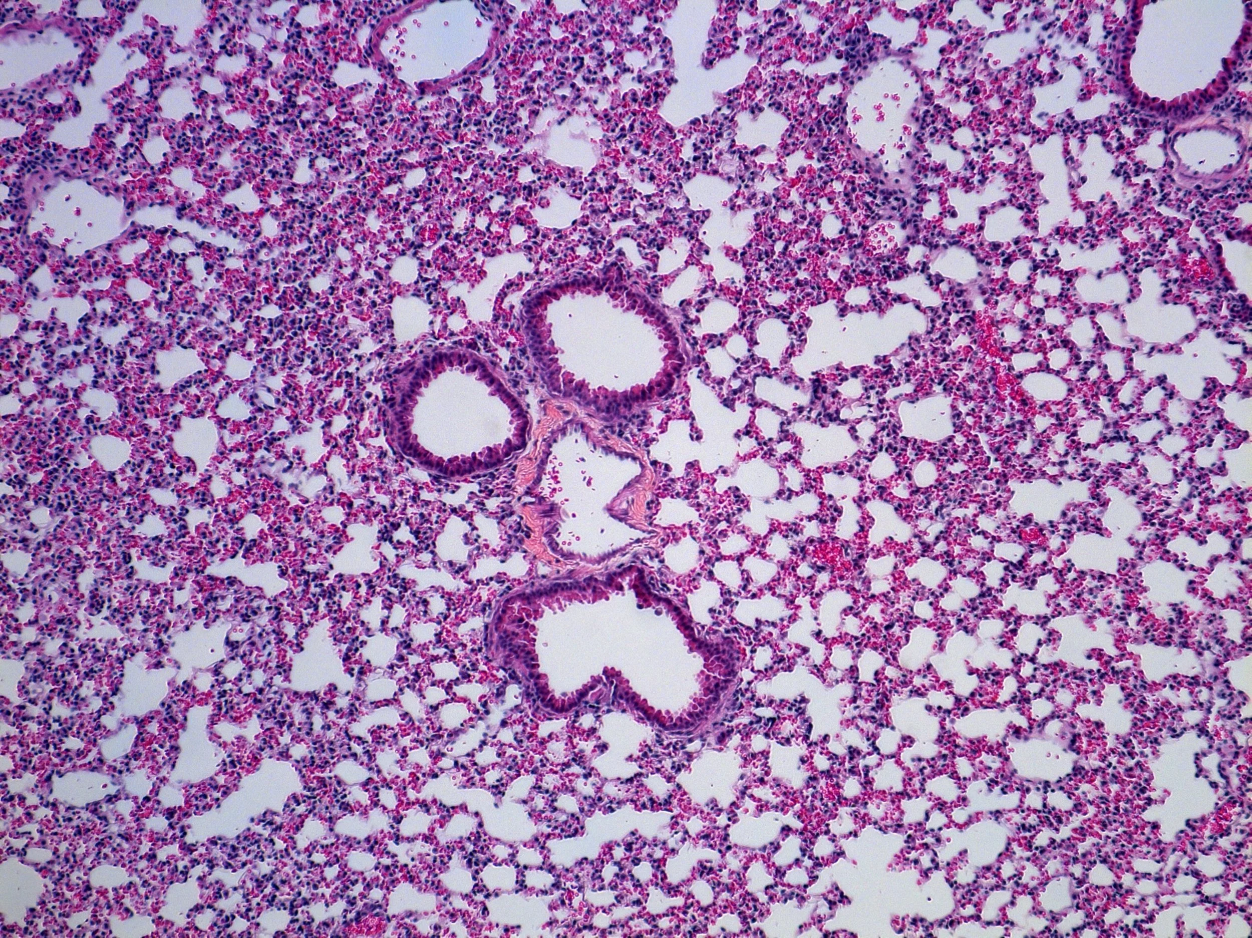 Microscopic view of lung tissue showing alveoli and bronchioles with cellular structures stained in purple and pink.