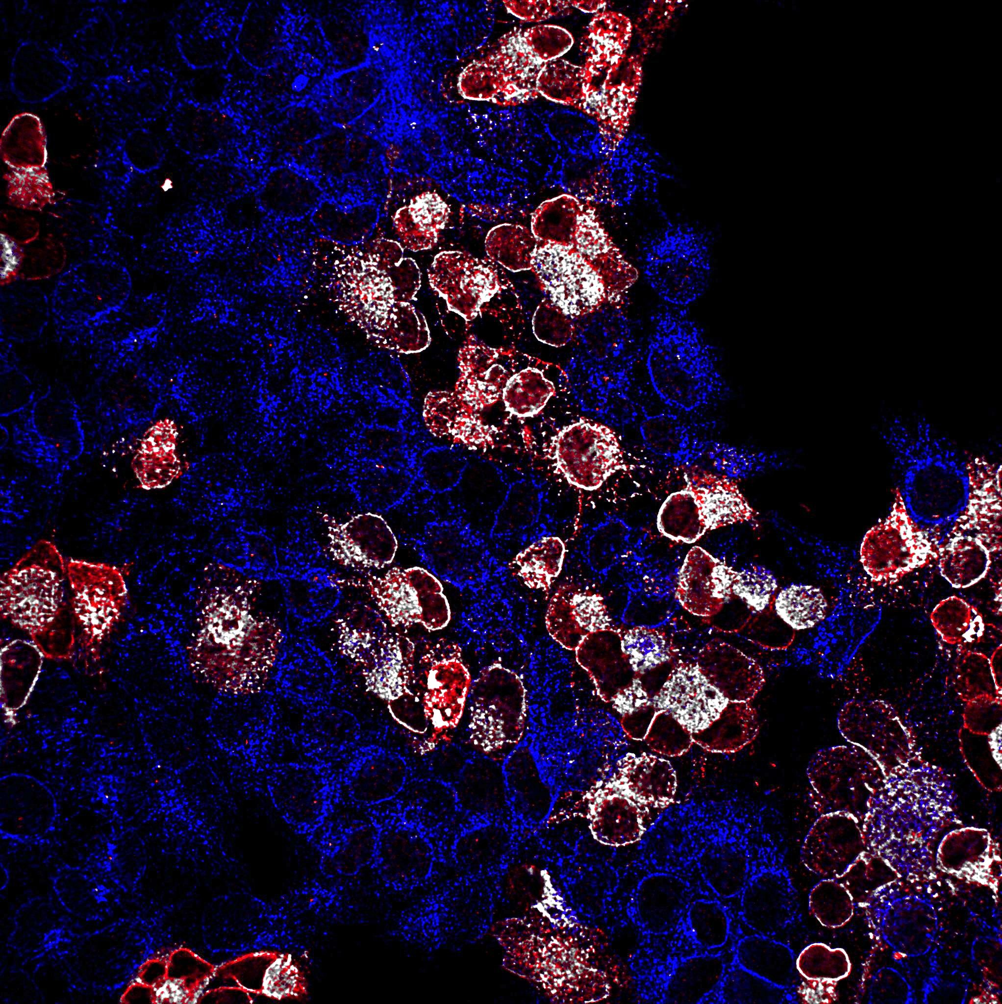 Microscopic view of cells with red and white structures against blue cell tissue, set on a black background.