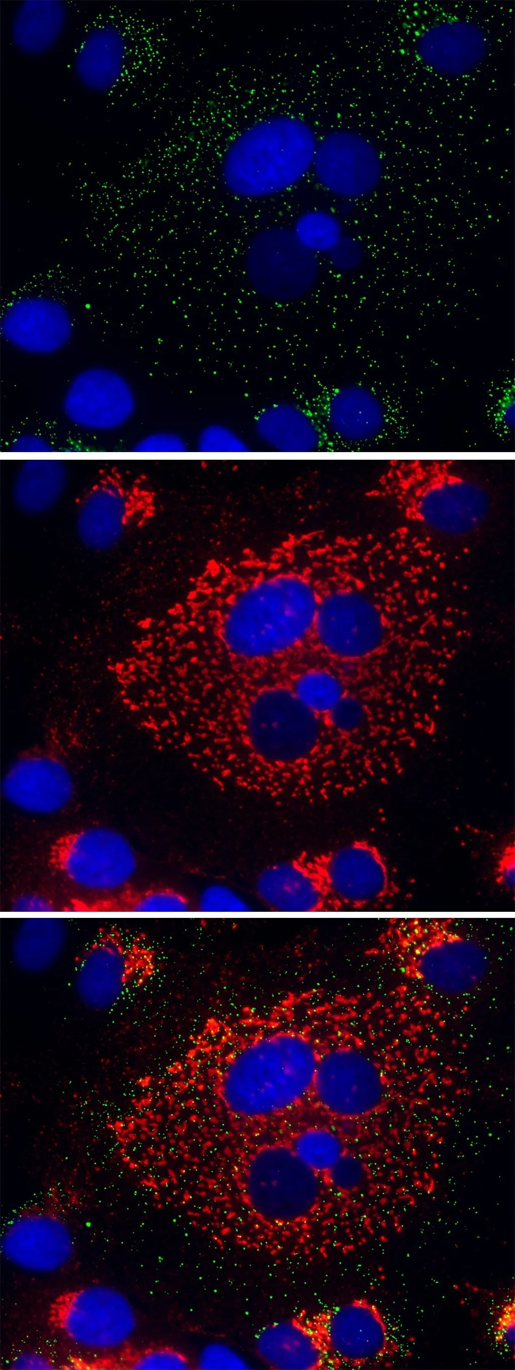 Microscopic images of cells stained with fluorescent dyes showing cell nuclei in blue, with green and red fluorescent markers highlighting different cellular components or activities.