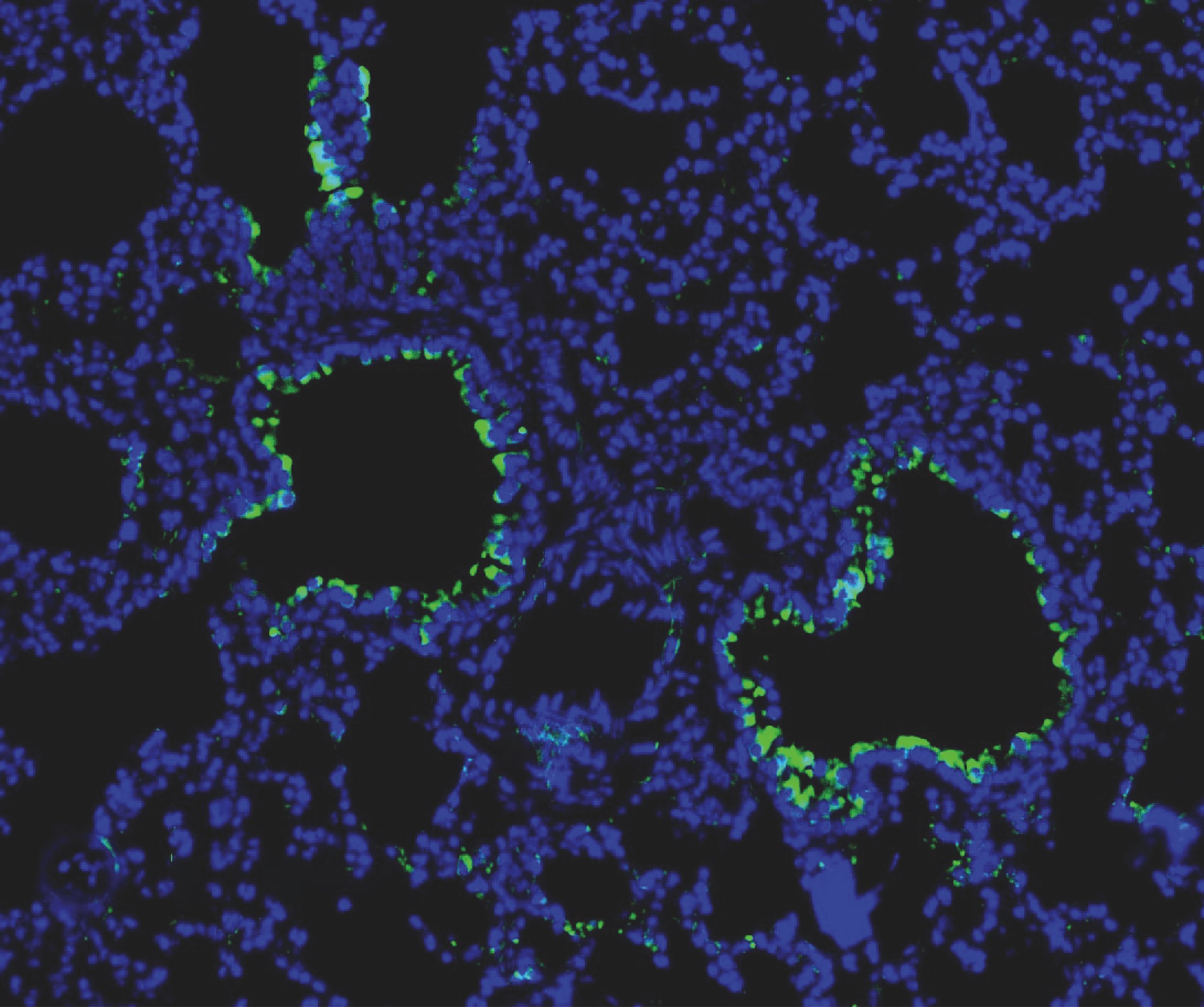 Fluorescent microscopy image showing cells with nuclei stained blue, cell membranes or structures highlighted in green, set against a black background.
