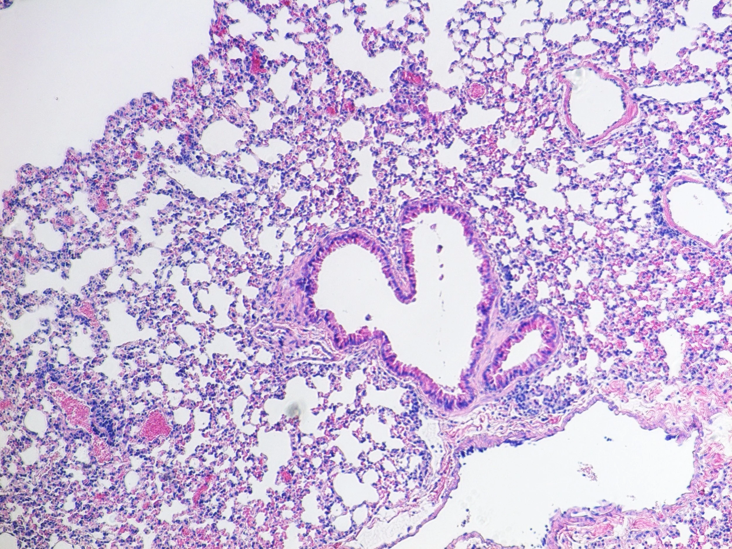 Microscopic view of lung tissue showing alveoli and bronchioles, stained with hematoxylin and eosin.