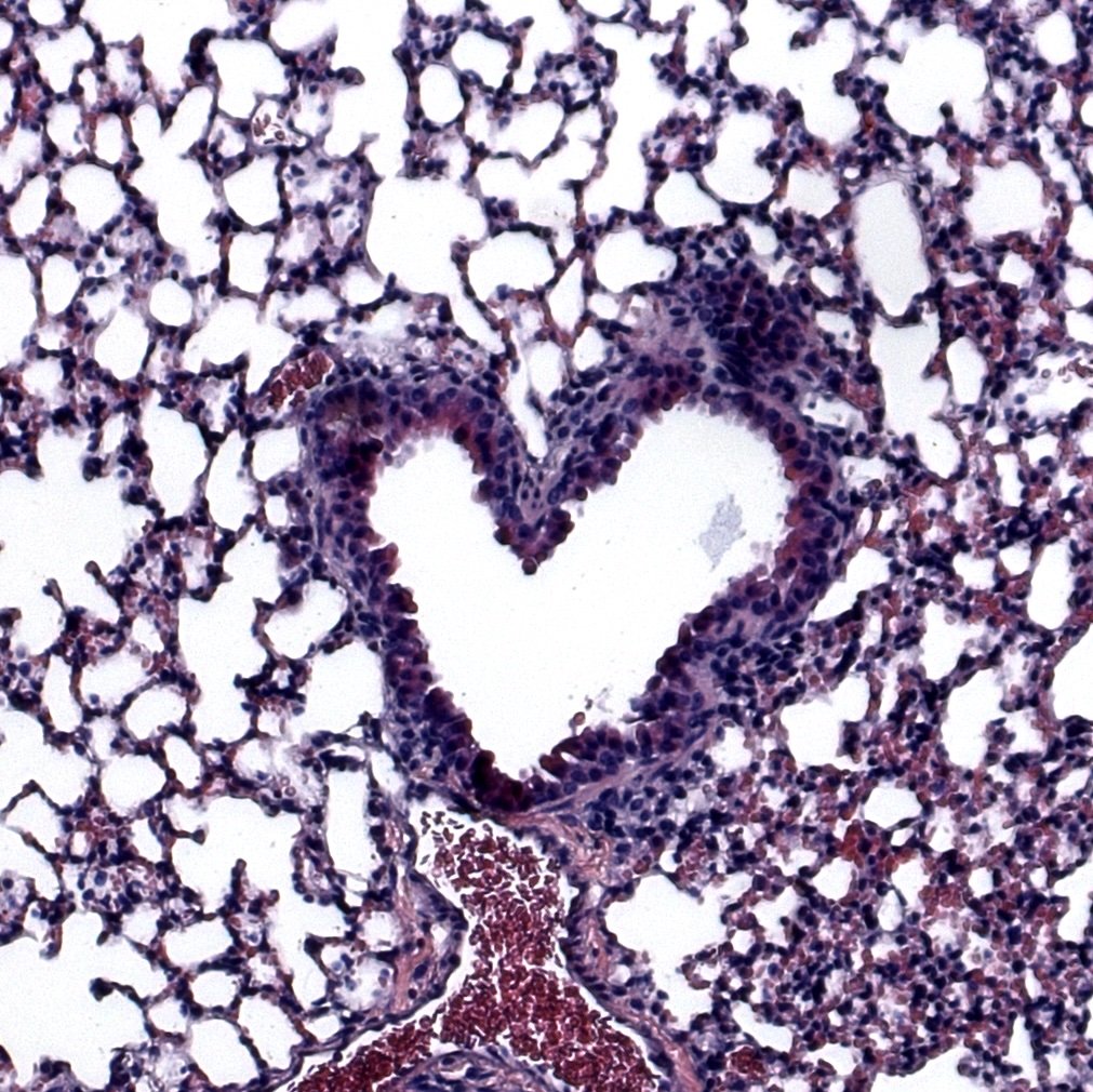 Microscopic view of lung tissue showing alveoli, blood vessels, and bronchi with a heart shape in the center.