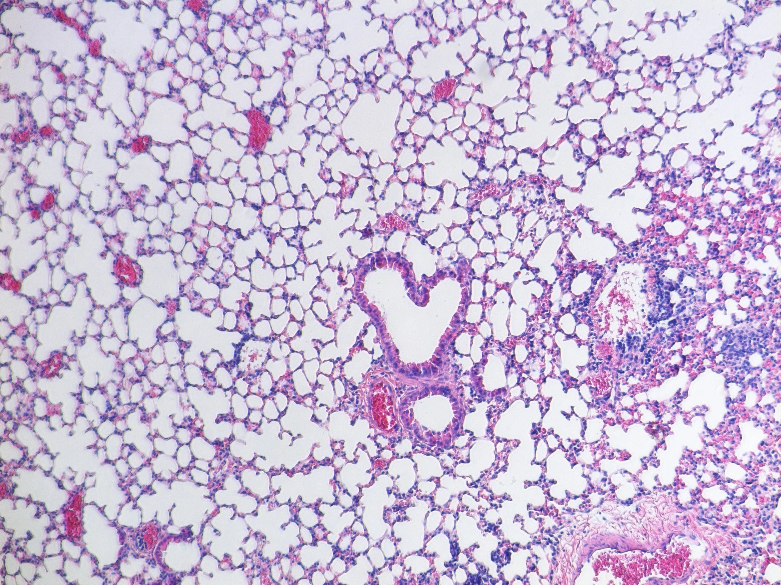 Microscopic image of human lung tissue showing alveoli and bronchial structures.