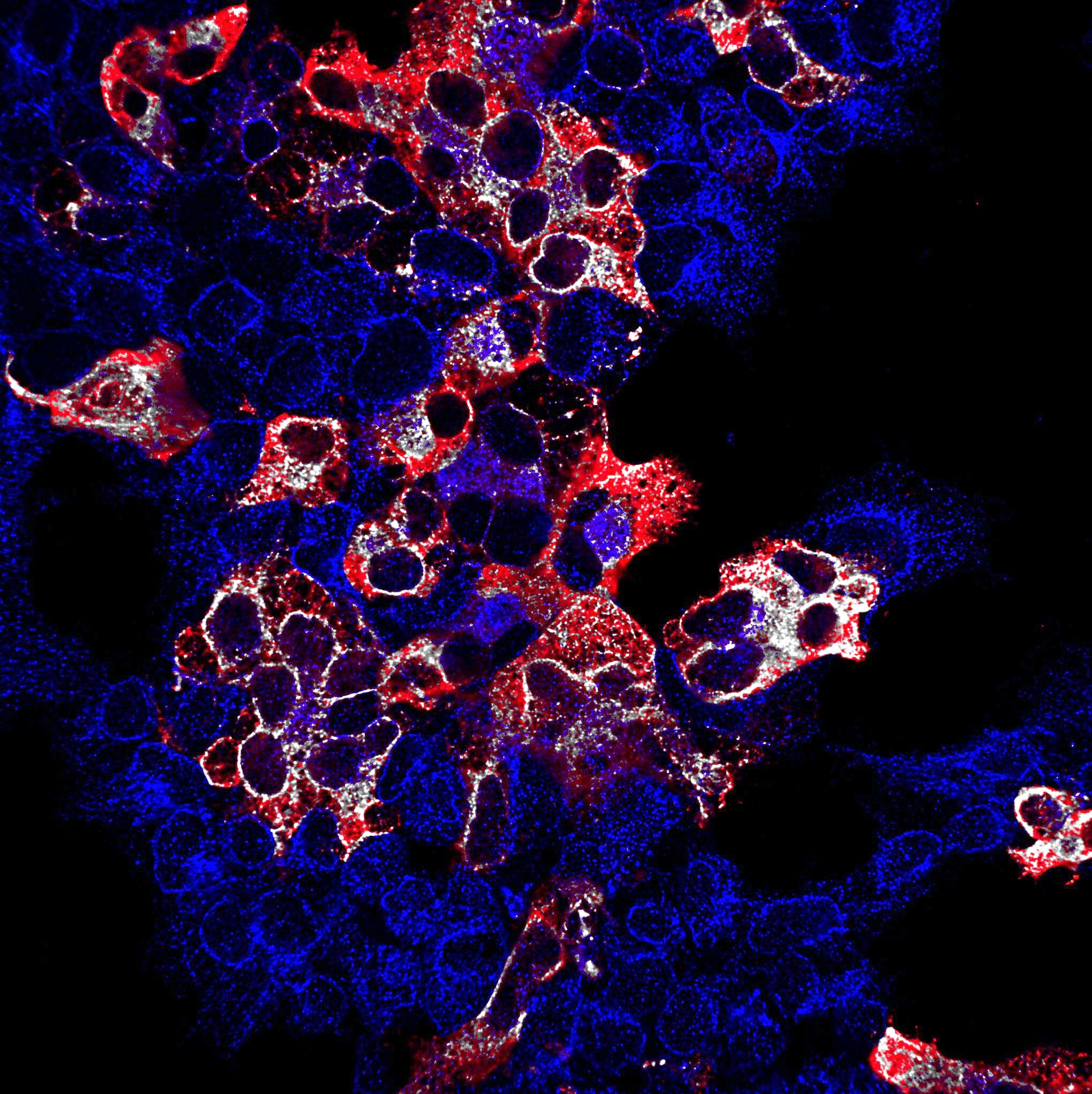 Microscopic view of cells with red, blue, and white staining on a black background.