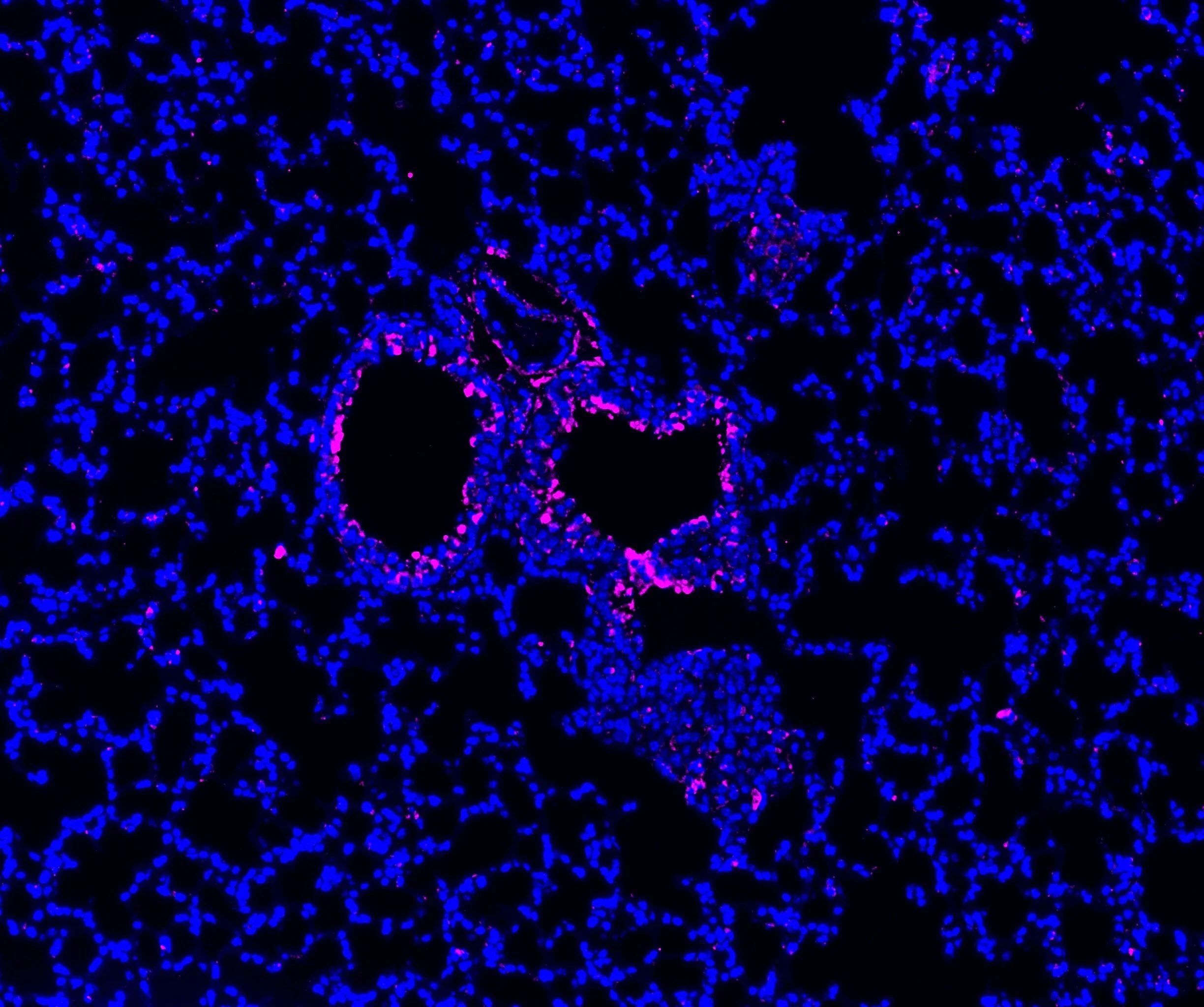 A fluorescent microscopy image showing a cluster of cells with distinctive blue and pink staining, highlighting cellular structures.