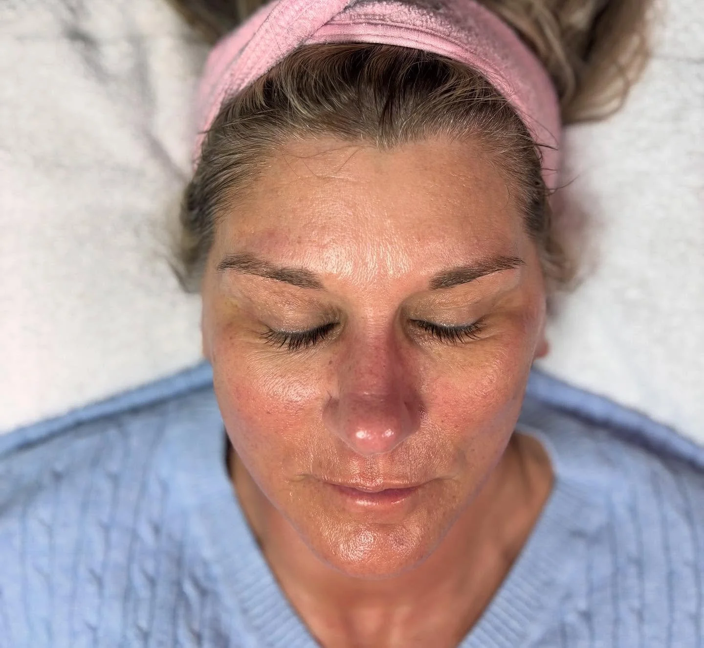 A woman with her eyes closed, lying on a white surface, wearing a pink headband and a blue top, with visible facial redness and glow.