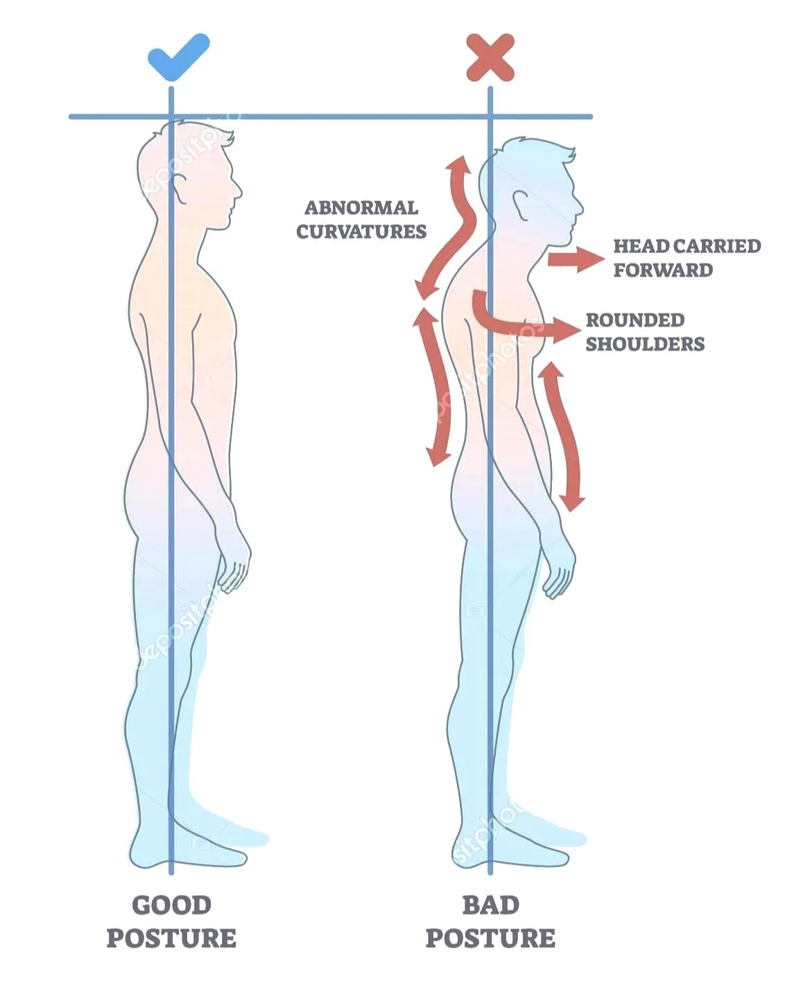 depositphotos_647353162-stock-illustration-rounded-shoulders-posture-body-alignment.jpg