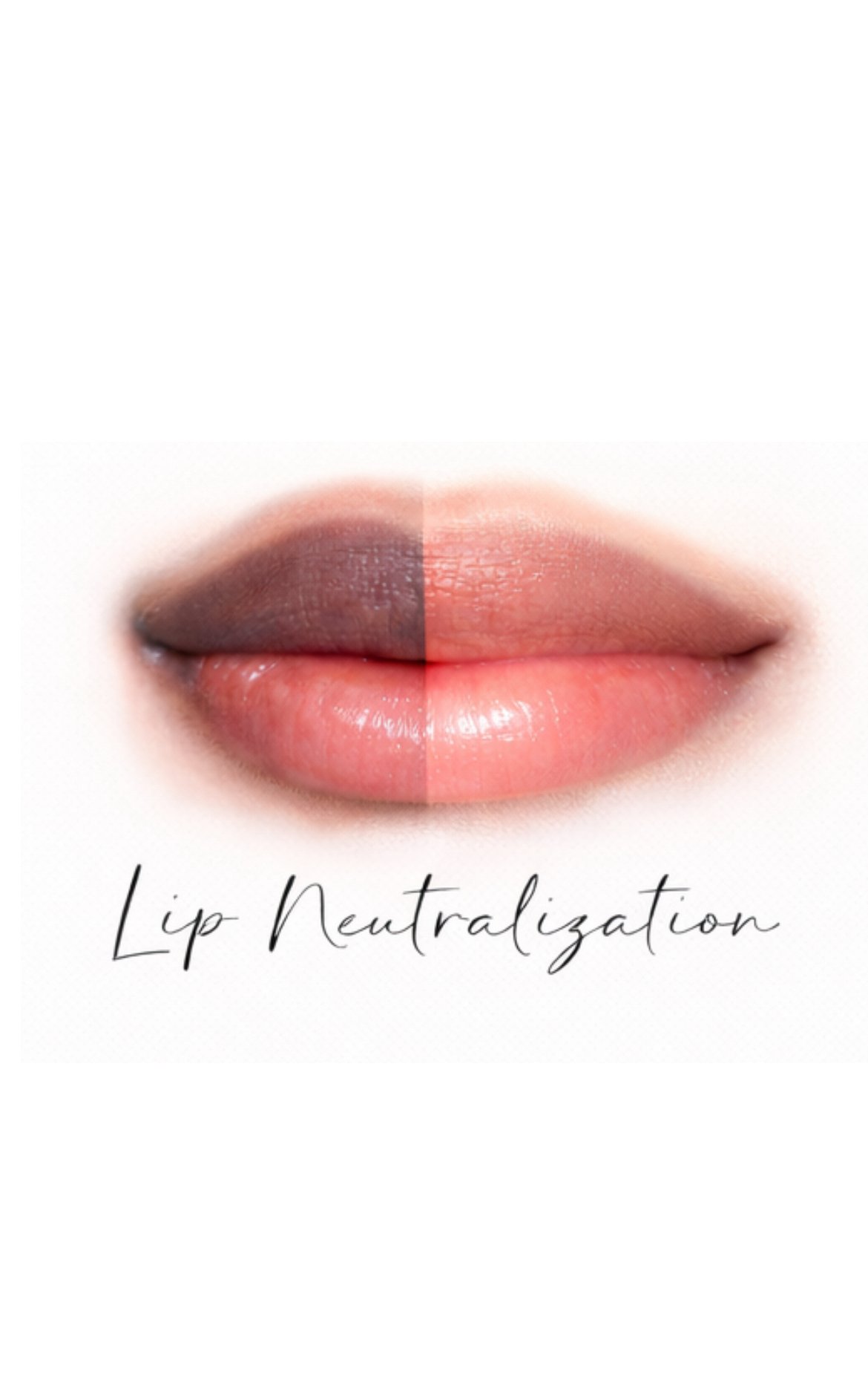 Lip Neutralization