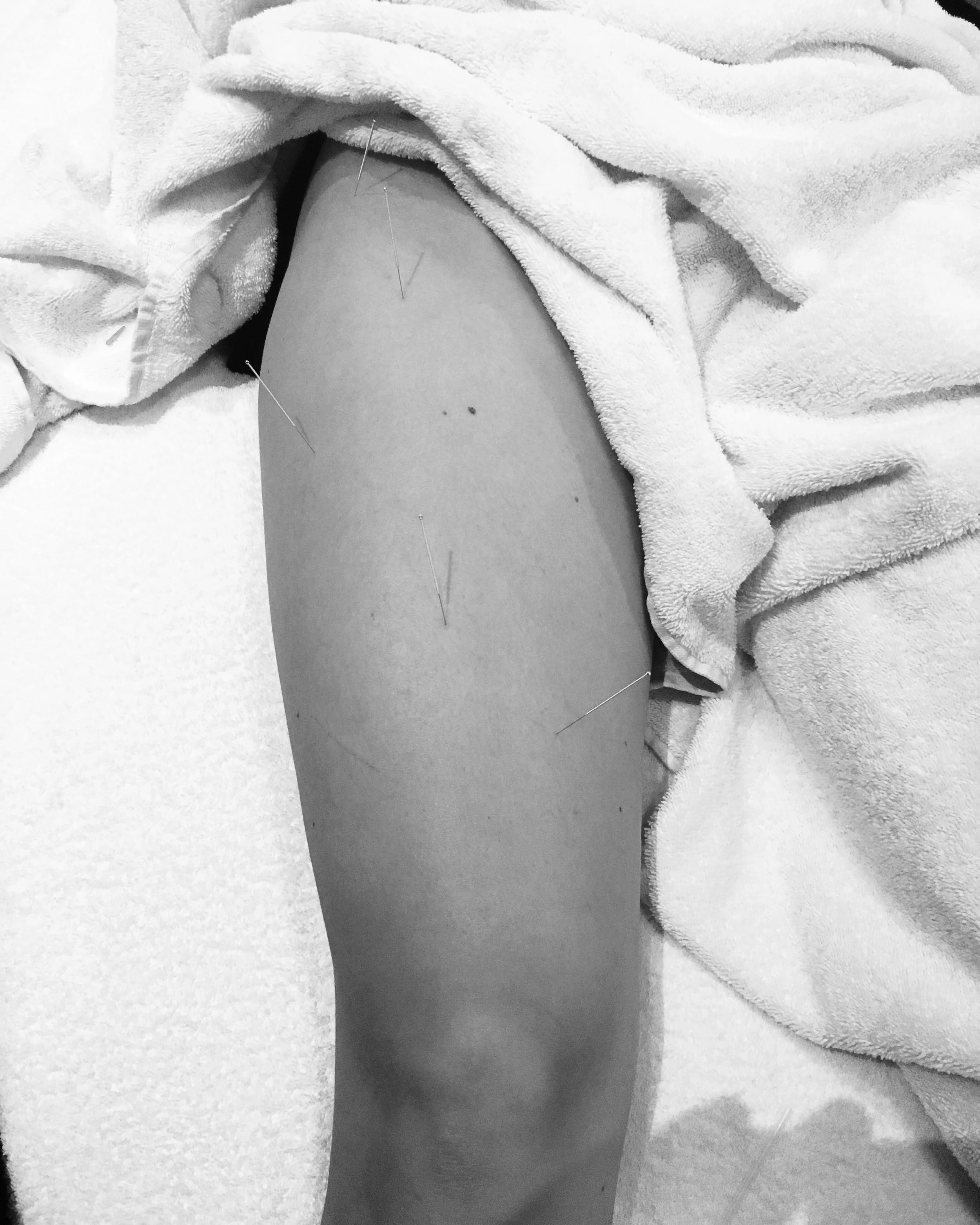 Clinical Myotherapy, Remedial massage, Diamond Creek, Pregnancy Massage, Dry needling