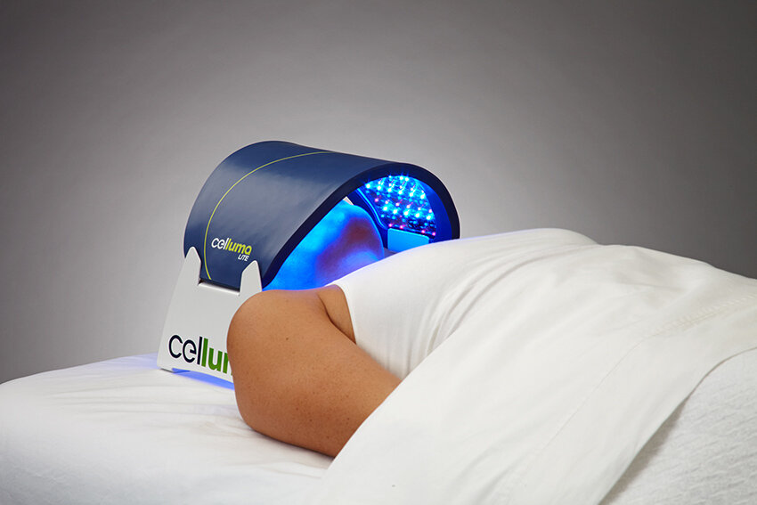 Celluma LED Light Therapy blue for Acne.
