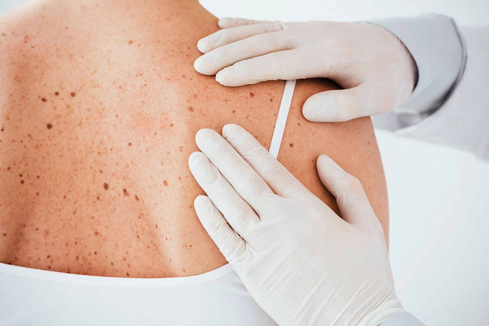 Close-up of a healthcare professional in white gloves administering an injection into a person's shoulder.