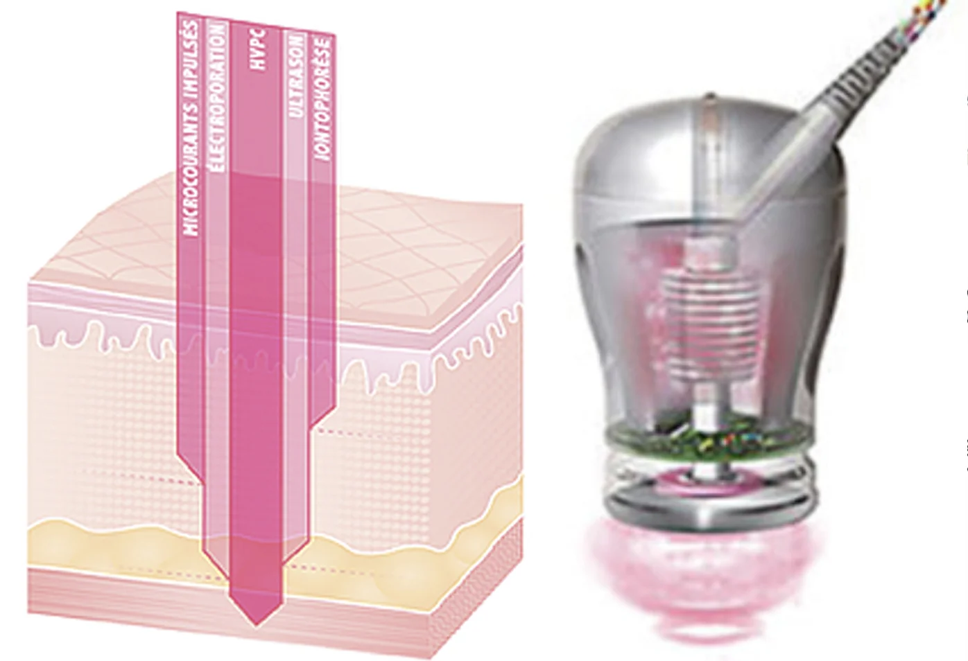 Electrotherapies and SRS Skin Remodelling System.jpg