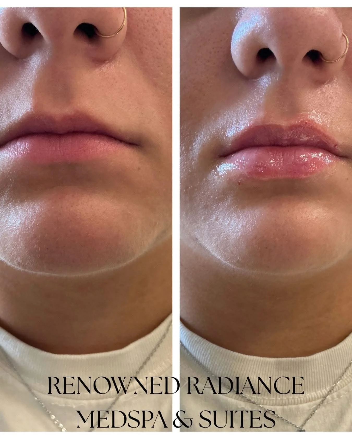 Medspa in Great Neck, NY 11021 l Weight Loss Near Me