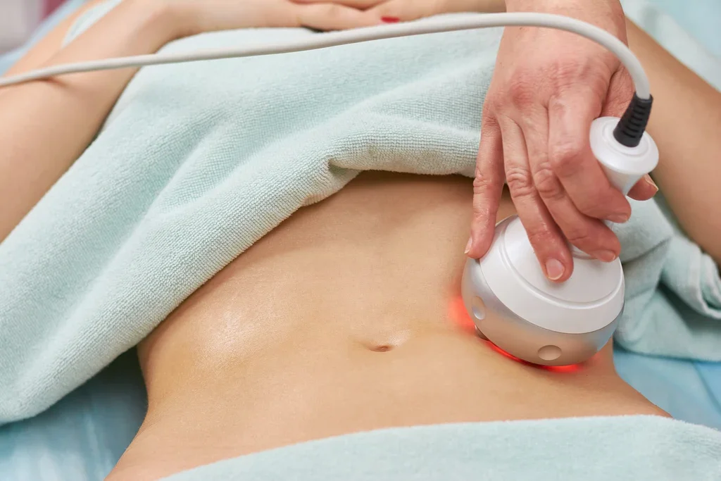 Body contouring treatment using radio frequency device on abdomen