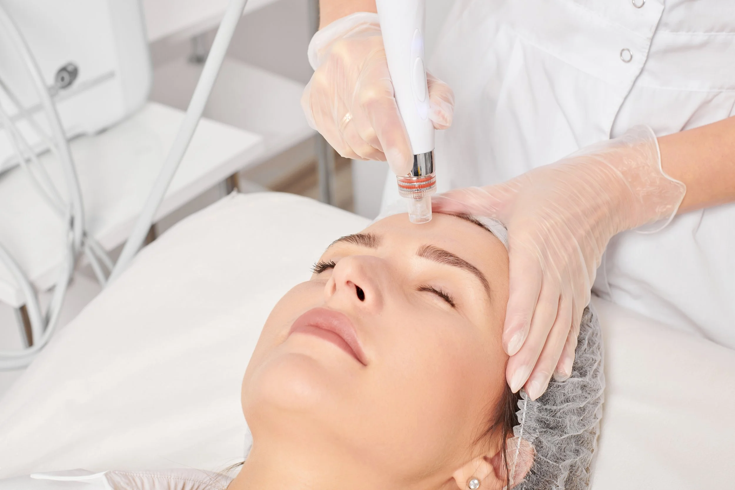 Medspa in Huntington Beach, CA, 92648 | Dermapen 4 Microneedling Near Me