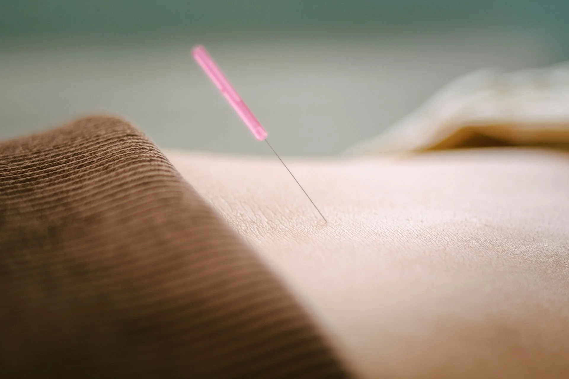 Close-up of acupuncture needle being inserted into a person's skin during treatment.