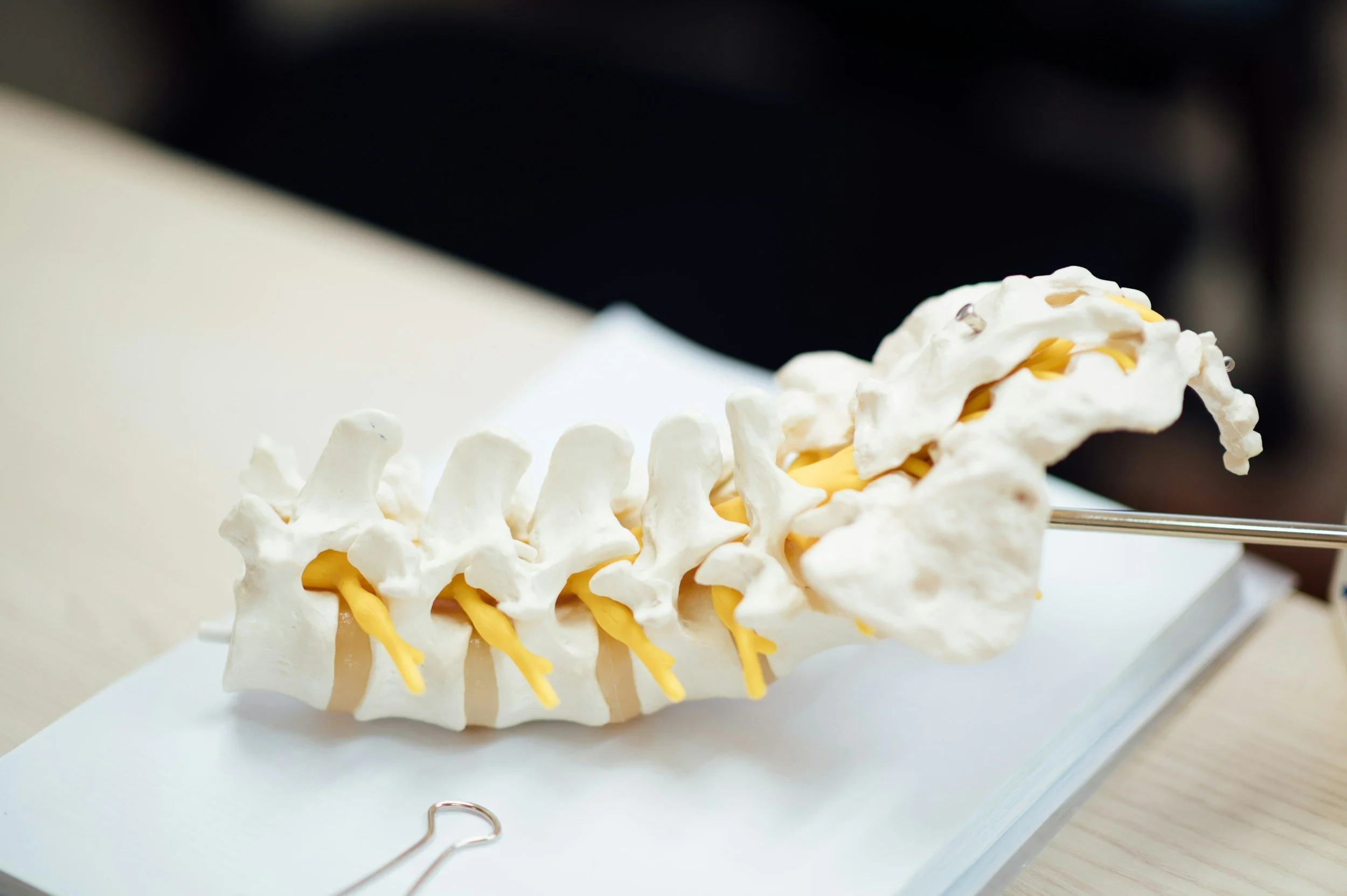 A life-sized model of a human spine with yellow nerves, displayed on a white surface, with a black background.