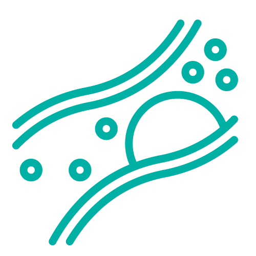 Icon representing mixed morphology lesion treatment with Serranator serration angioplasty
