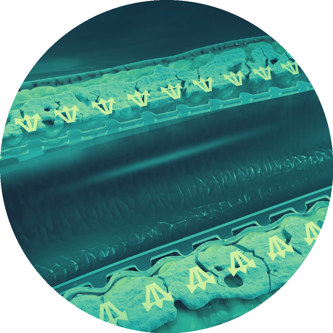 Serranator mechanism of action cross-section showing arterial expansion along serration line